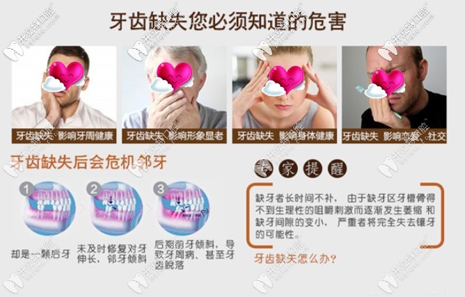缺牙的危害是大大滴 缺牙的危害是大大滴