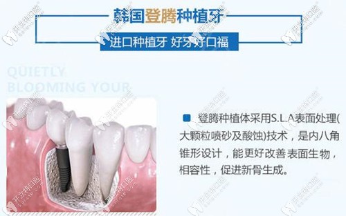 福州维乐口腔韩国登腾种植牙 福州维乐口腔韩国登腾种植牙