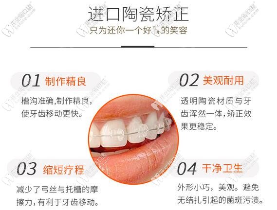 陶瓷半隐形托槽的优势