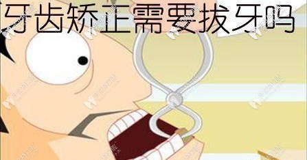 牙齿矫正都需要拔牙吗