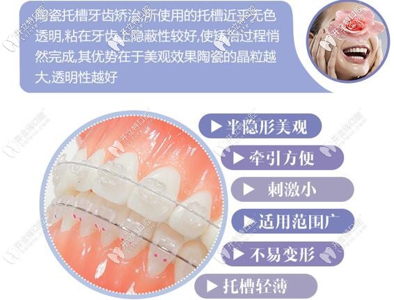 深圳微尔口腔美国3M陶瓷半隐形牙齿矫正价格