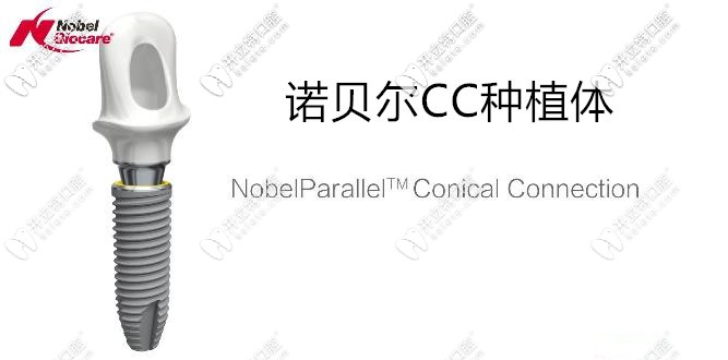 诺贝尔CC种植体
