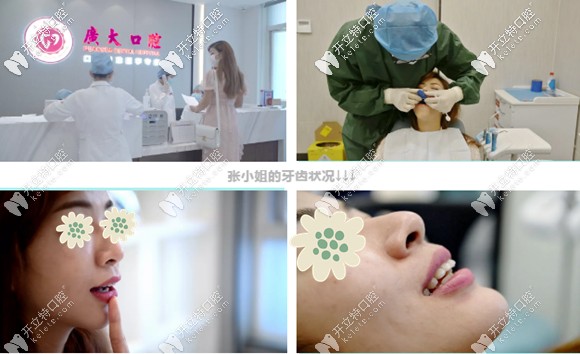 关于舌侧矫正和唇侧矫正的区别 关于舌侧矫正和唇侧矫正的区别