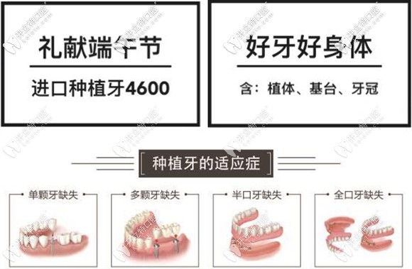 在太原做半口半固定种植牙只需27600元起,这价格值得了解哦!