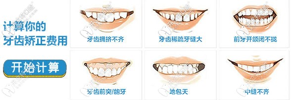 想在洛阳做隐形矫正的朋友速来关注隐适美隐形牙套价格吧