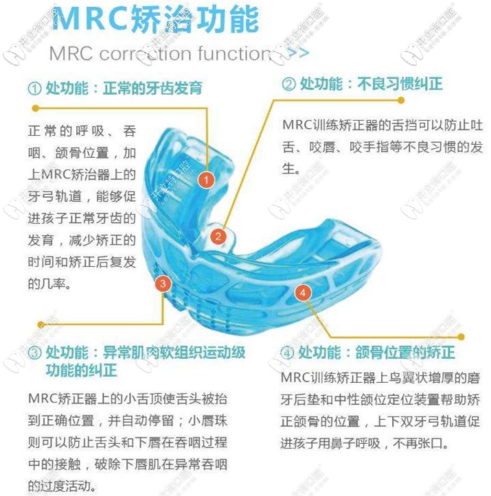 儿童MRC肌功能矫治器