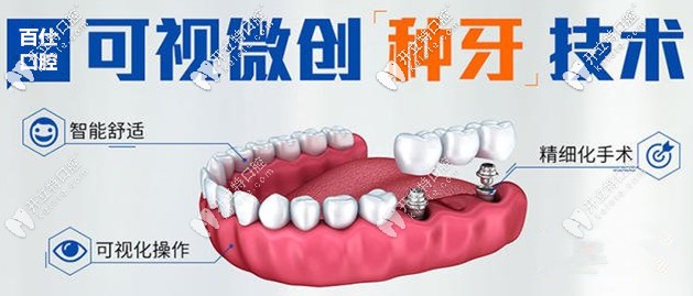 微创种植牙技术