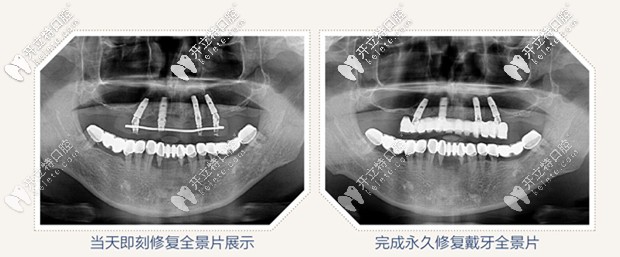 全景片图示