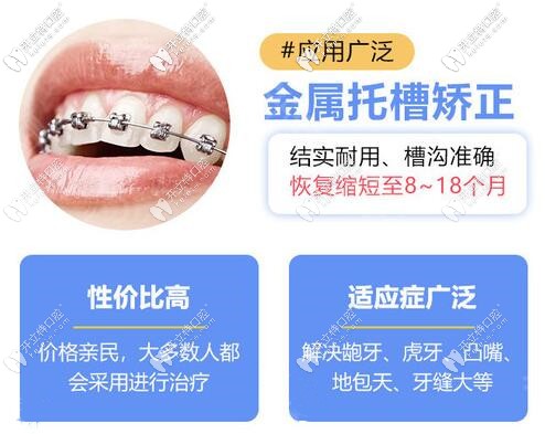 苏州金属托槽牙齿矫正价格