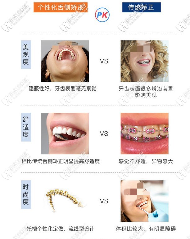 个性舌侧隐形矫正和传统矫正对比