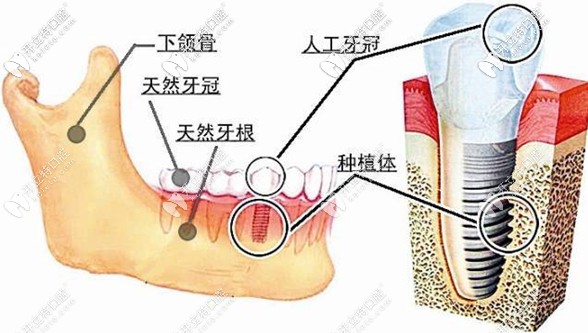 以色列雅定和意大利bb种植系统价格