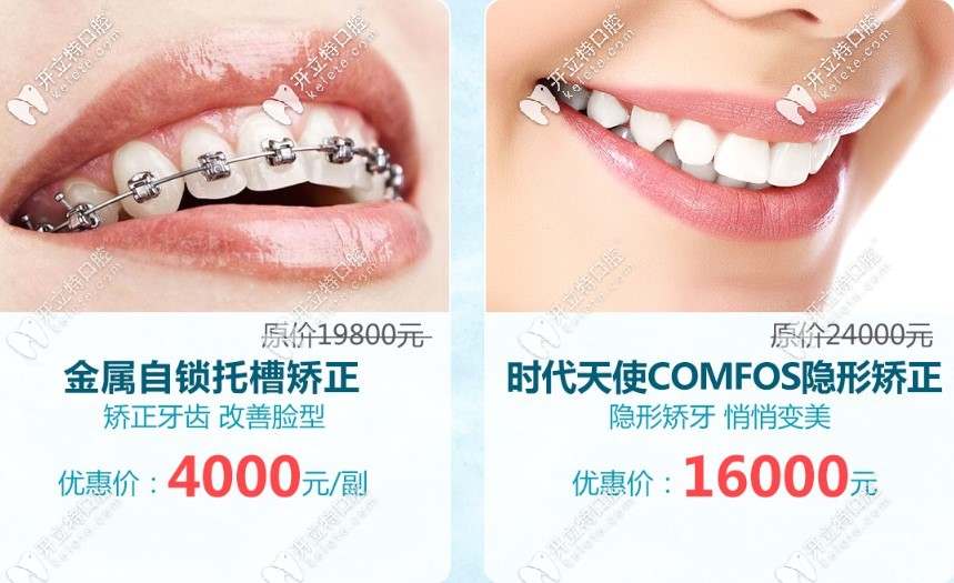 广州市牙套价格表请收藏,金属自锁+隐形矫正的费用值得一观