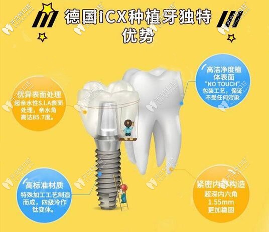 苏州美奥德国ICX种植牙价格 苏州美奥德国ICX种植牙价格