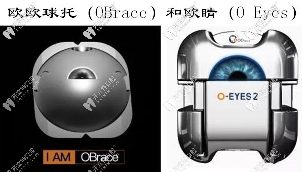 欧睛(O-Eyes)球面金属自锁托槽牙齿矫正怎么样