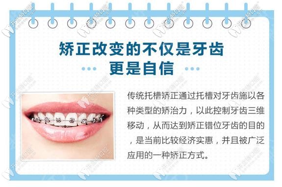 传统的钢丝矫正优势 传统的钢丝矫正优势