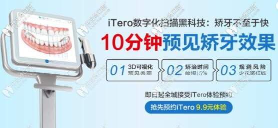 itero口扫价格惠州致美口腔
