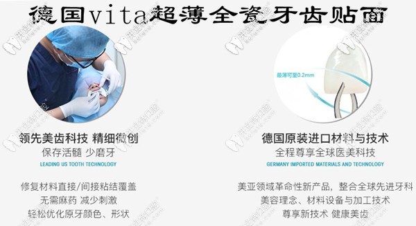 德国vita超薄瓷贴面不磨牙也不会脱落