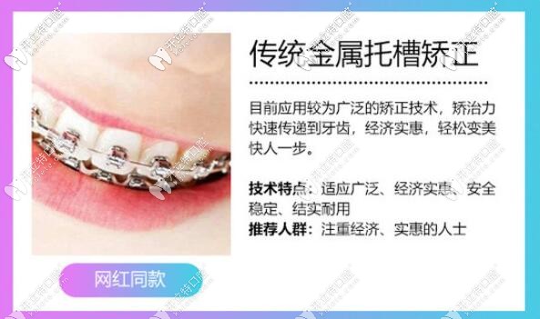 传统金属托槽矫正优点 传统金属托槽矫正优点