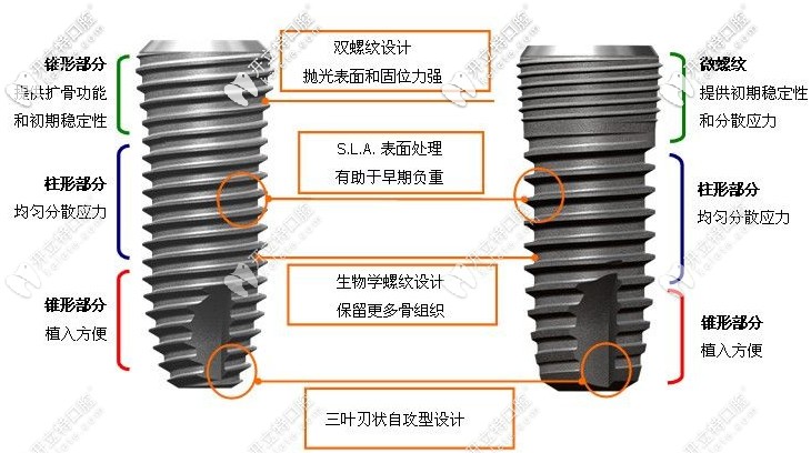 种植体的优势