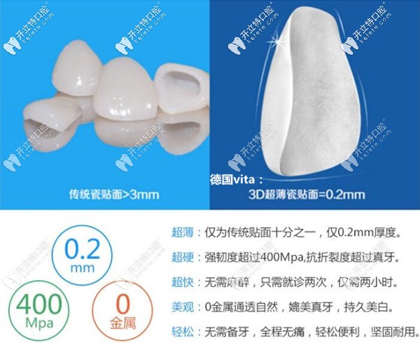 德国vita超薄玻璃陶瓷和琥珀瓷贴面价格的区别