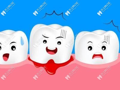 牙周炎牙龈出血情况
