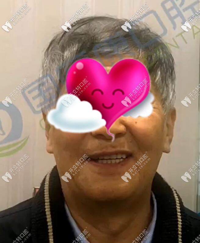 71岁老人做全口种植牙后效果图