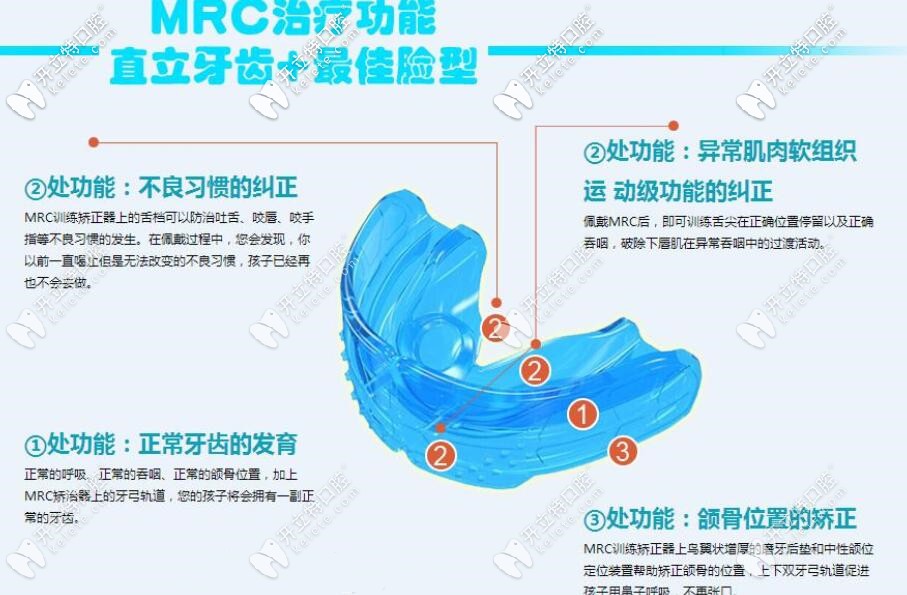 孩子早期牙齿畸形可以用MRC进行干预矫正