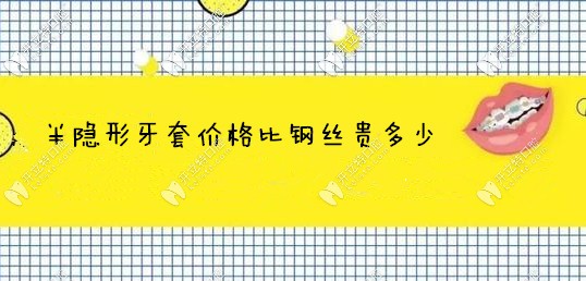 半隐形牙套价格比钢丝贵多少