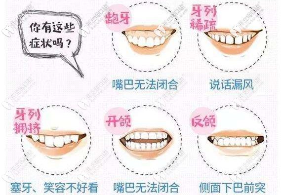你的牙齿有这几种情况吗？