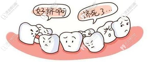 儿童牙列不齐可以矫正吗 儿童牙列不齐可以矫正吗