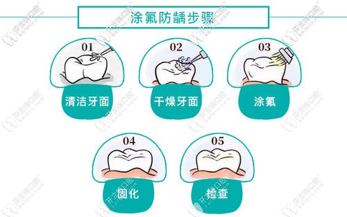 涂氟的过程 涂氟的过程