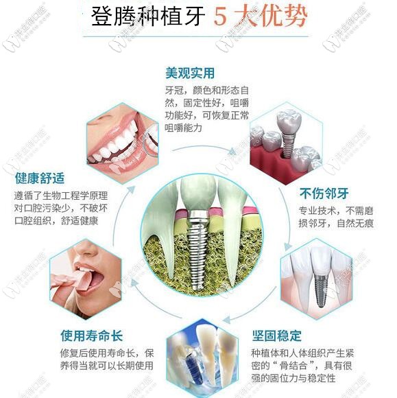 深圳正夫口腔韩国登腾种植牙优势