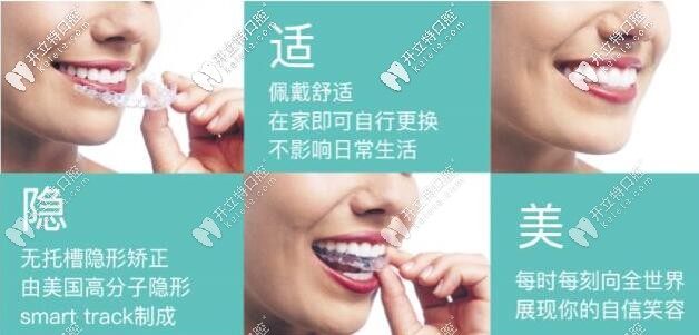 隐适美隐形矫正的优势 隐适美隐形矫正的优势