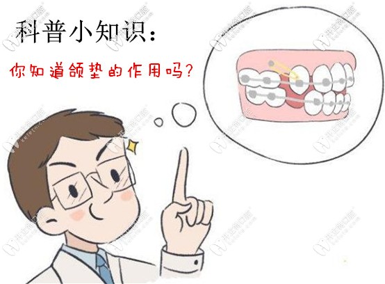 你知道颌垫的作用有哪些吗 你知道颌垫的作用有哪些吗