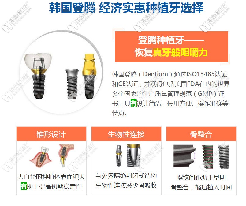 韩国登腾种植体的优势 韩国登腾种植体的优势