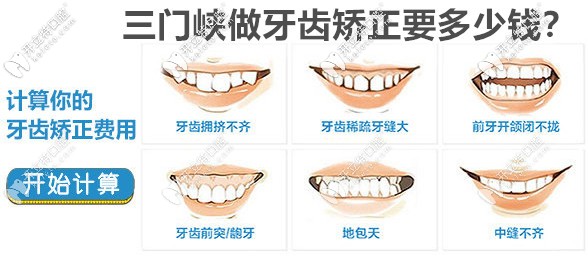 三门峡靠谱的口腔机构做钢丝矫正和隐形牙套费用被公开啦