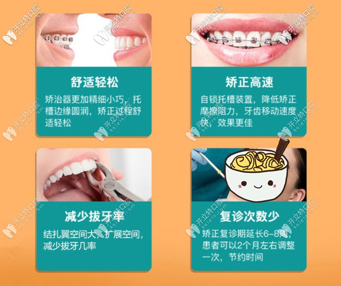 金属自锁牙套的优点 金属自锁牙套的优点