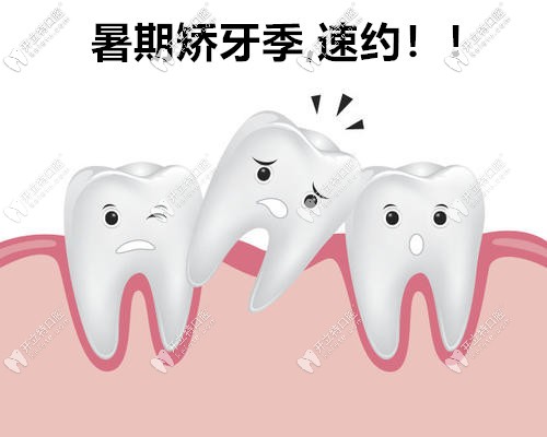 暑期矫正大放价,苏州做时代天使comfos牙套价格低到18000元起