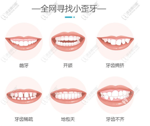 为什么要矫正牙齿