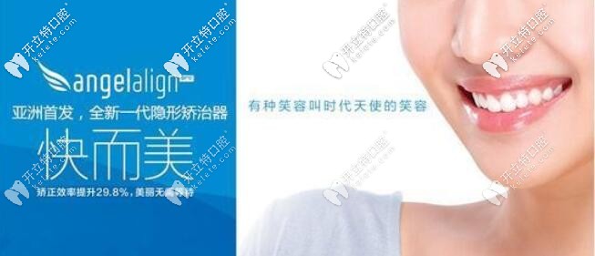 时代天使隐形矫正 时代天使隐形矫正