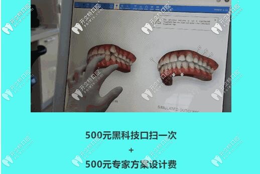 中山好民生口腔口扫体验 中山好民生口腔口扫体验