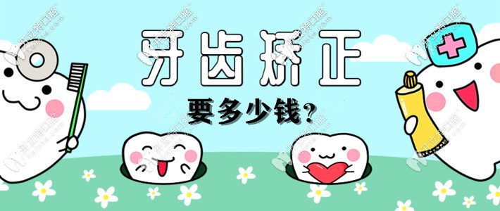 推送一篇牙齿矫正价格表,帮你解答杭州整牙齿一般多少钱