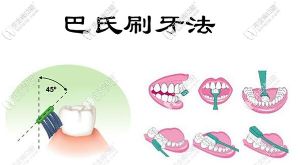 巴氏刷牙法 巴氏刷牙法