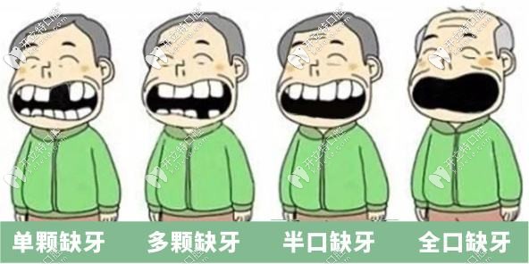 牙齿缺失了怎么办