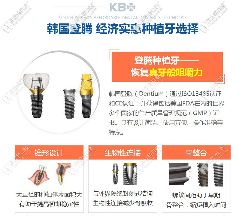 韩国登腾种植牙的优势