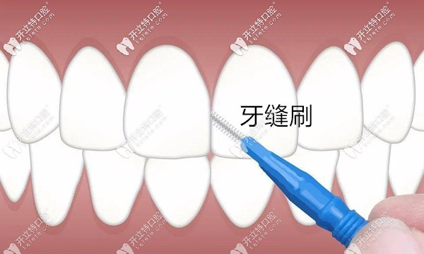 需要多种方法联合清洁牙齿