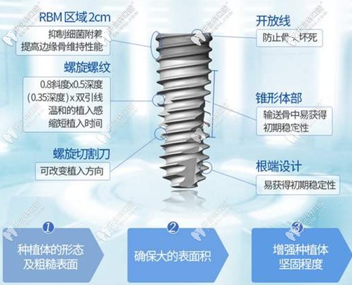 种植牙的特点