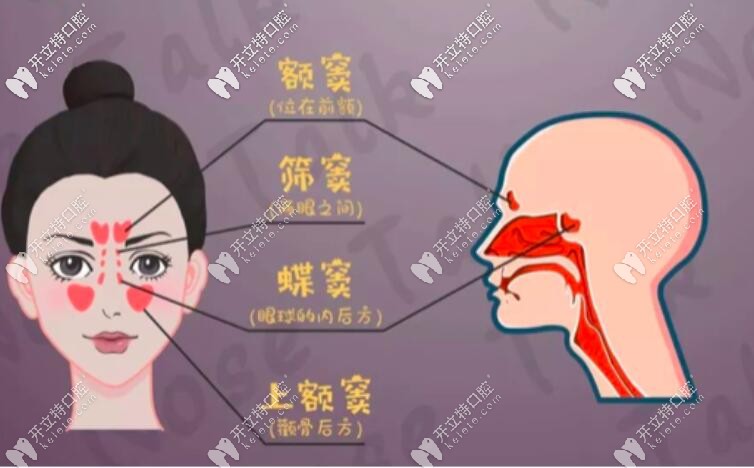 怎么判断上颌窦穿孔