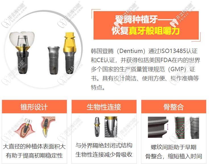 韩国登腾种植牙质量怎么样