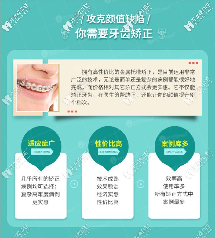 普通金属托槽矫正的优势 普通金属托槽矫正的优势